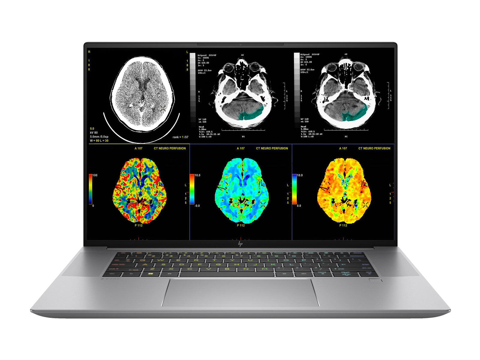 Station de lecture de revue clinique complète | 2 x lg 27 "8MP Couleur Clinical Review Affichages | HP ZBOOK Studio 16 G10 | DICTATION MIC | PLANCELL PANCULATION D'ÉTALBRATION (LGHP16G10)