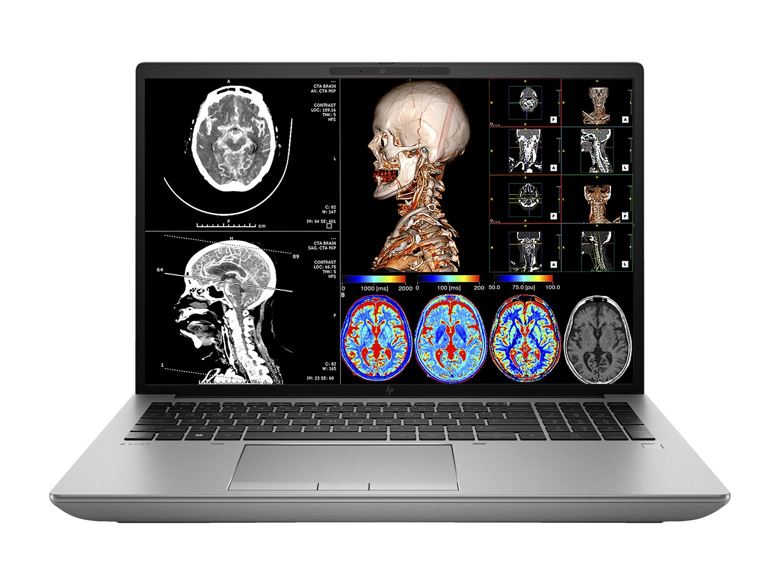 HP ZBook Fury 16 G9 Mobile Workstation | 16" WUXGA DICOM Calibrated | Core i7-12800HX @ 4.80GHz | 16-core | 32GB DDR5 | 1TB NVMe | Radeon Pro W6600M 8GB | WiFi 6 | Win10-11 Pro
