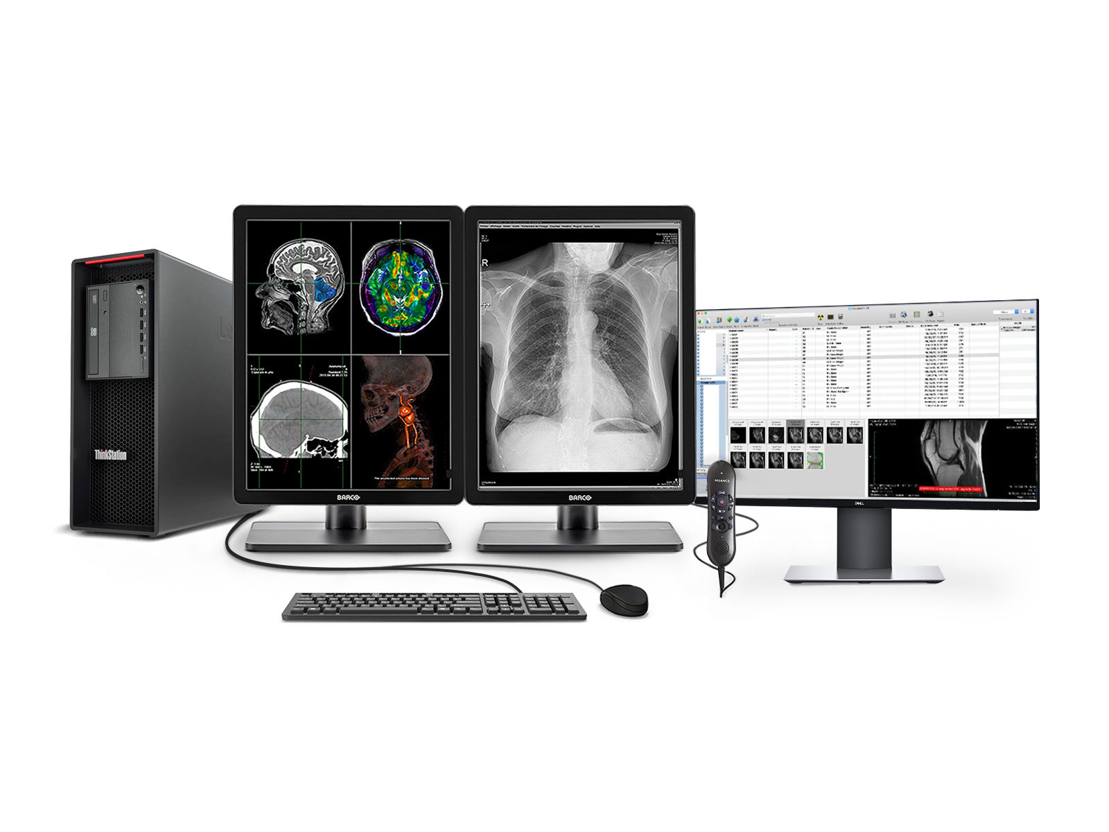 Complete PACS General Radiology Station | Barco 3MP Color LED Displays | Lenovo Workstation | Dictation Mic | Worklist Monitor (3321Z4R) Monitors.com 