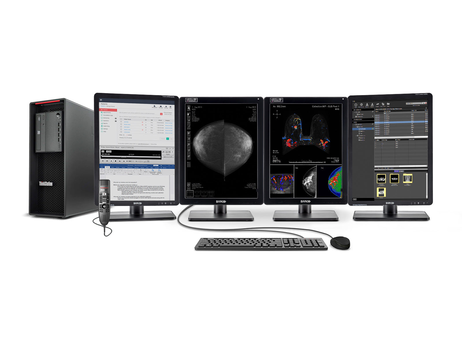 Complete Mammography Reading Station | Lenovo Workstation