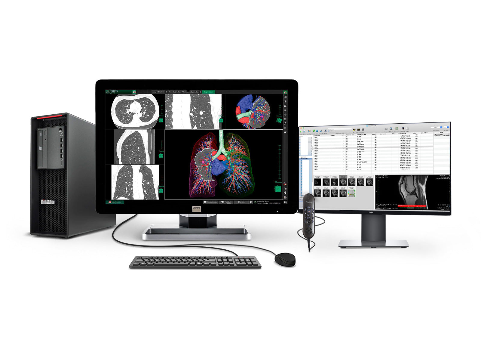 Barco Complete PACS General Radiology Station | Lenovo Workstation