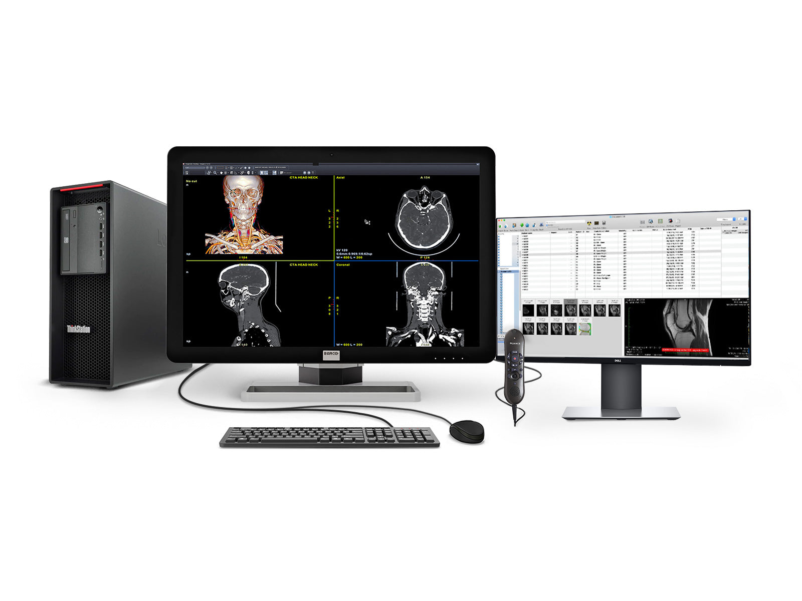 Barco General Radiology Reading Station | Coronis 6MP MDCC-6430 | Lenovo Workstation | Nuance Mic | 24" Worklist Monitors (6430Z4R)