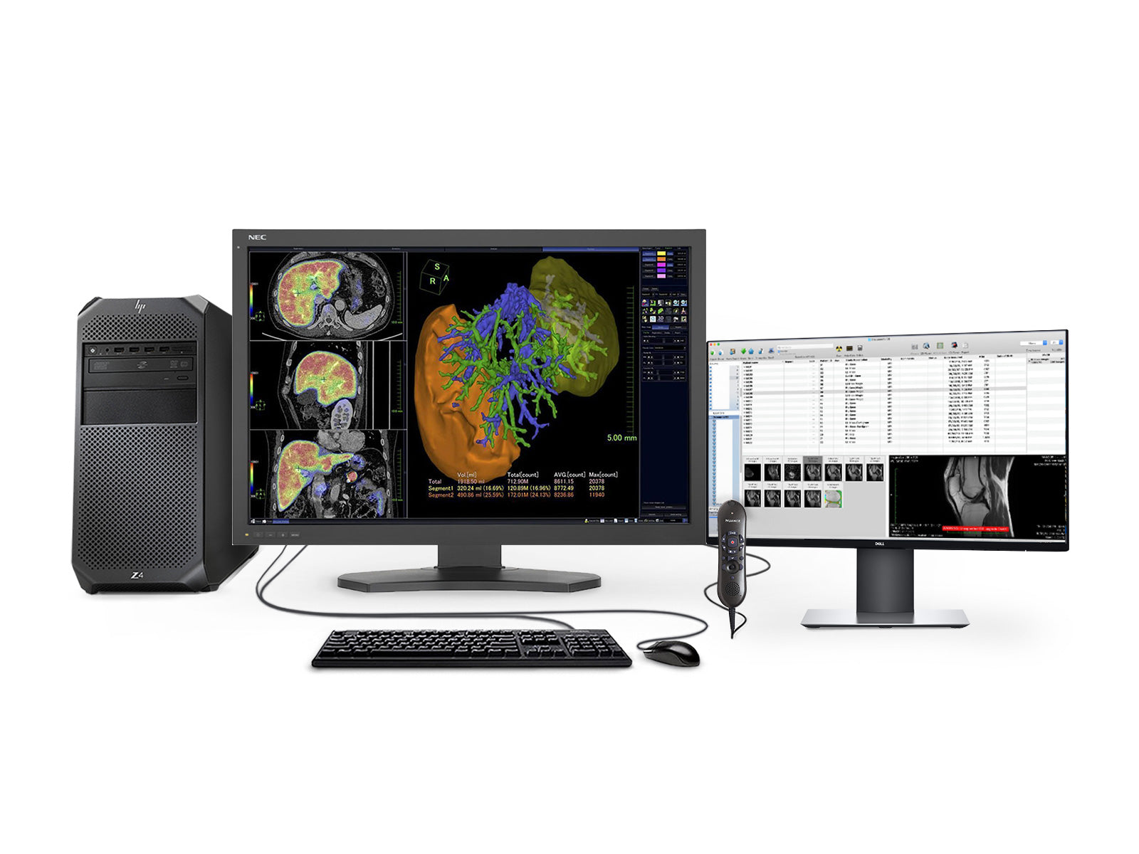 NEC Complete PACS General Radiology Station | HP Workstation