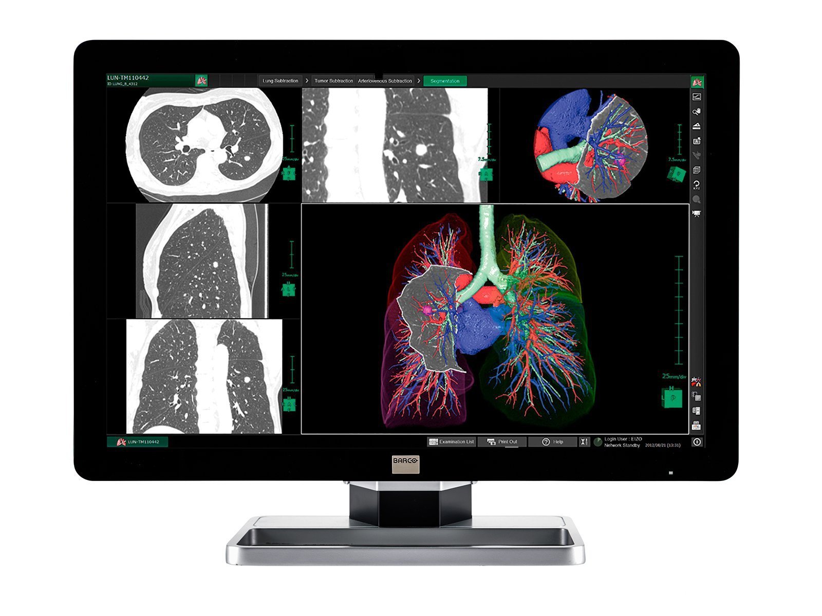 Complete PACS General Radiology Station | Barco 6MP Color LED Display | HP Workstation | Dictation Mic | Worklist Monitor (6330Z4R) Monitors.com 