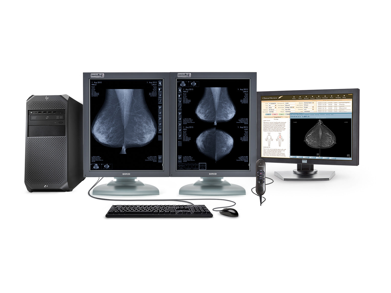 Complete Mammography Reading Station | Barco 5MP Grayscale Displays | HP Workstation | Dictation Mic | Worklist Monitor (MG5121Z4R) Monitors.com 