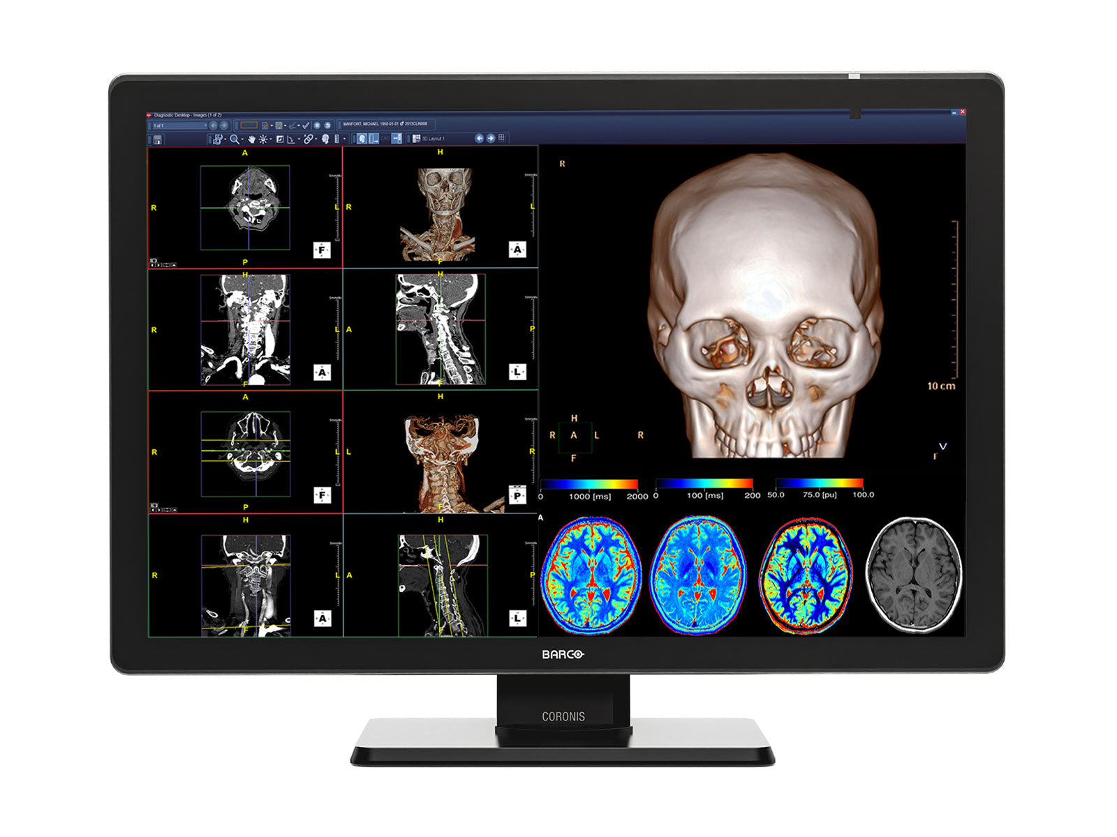 Barco Coronis Fusion MDCC-4430 4MP 30 "Renkli LED Tıbbi Diagnostik PACS Ekran