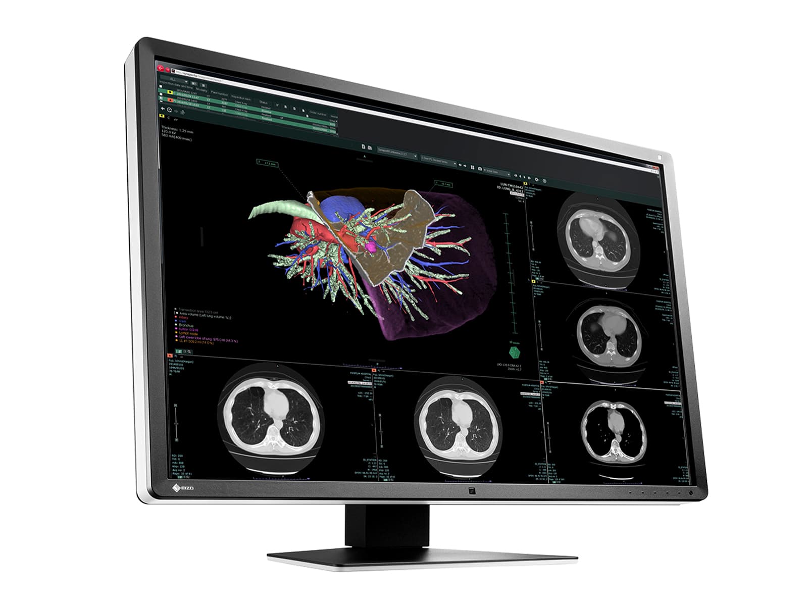 Eizo RadiForce RX660 6MP 30" Color LED General Radiology PACS Display (RX660-AR) Monitors.com 