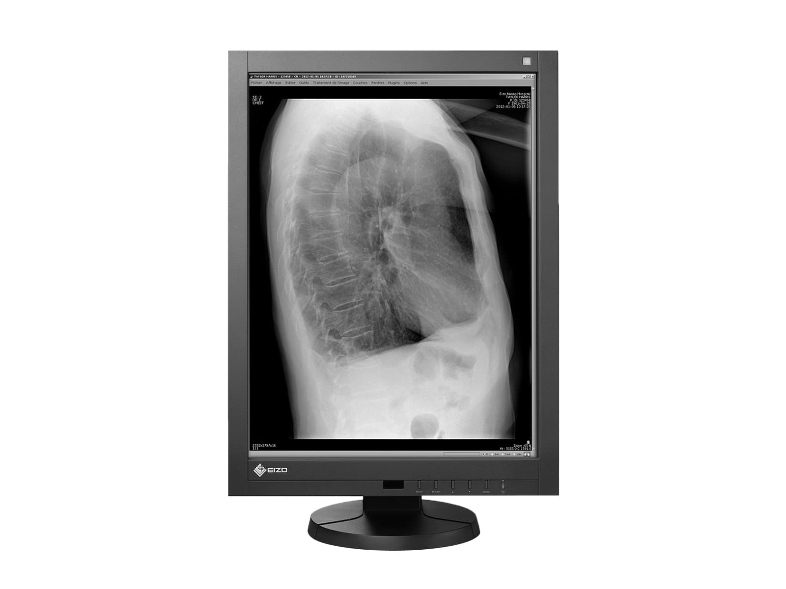 Eizo RadiForce GX340 3MP 21" Grayscale LED General Radiology Diagnostic Display Monitor (GX340-CL) Monitors.com 