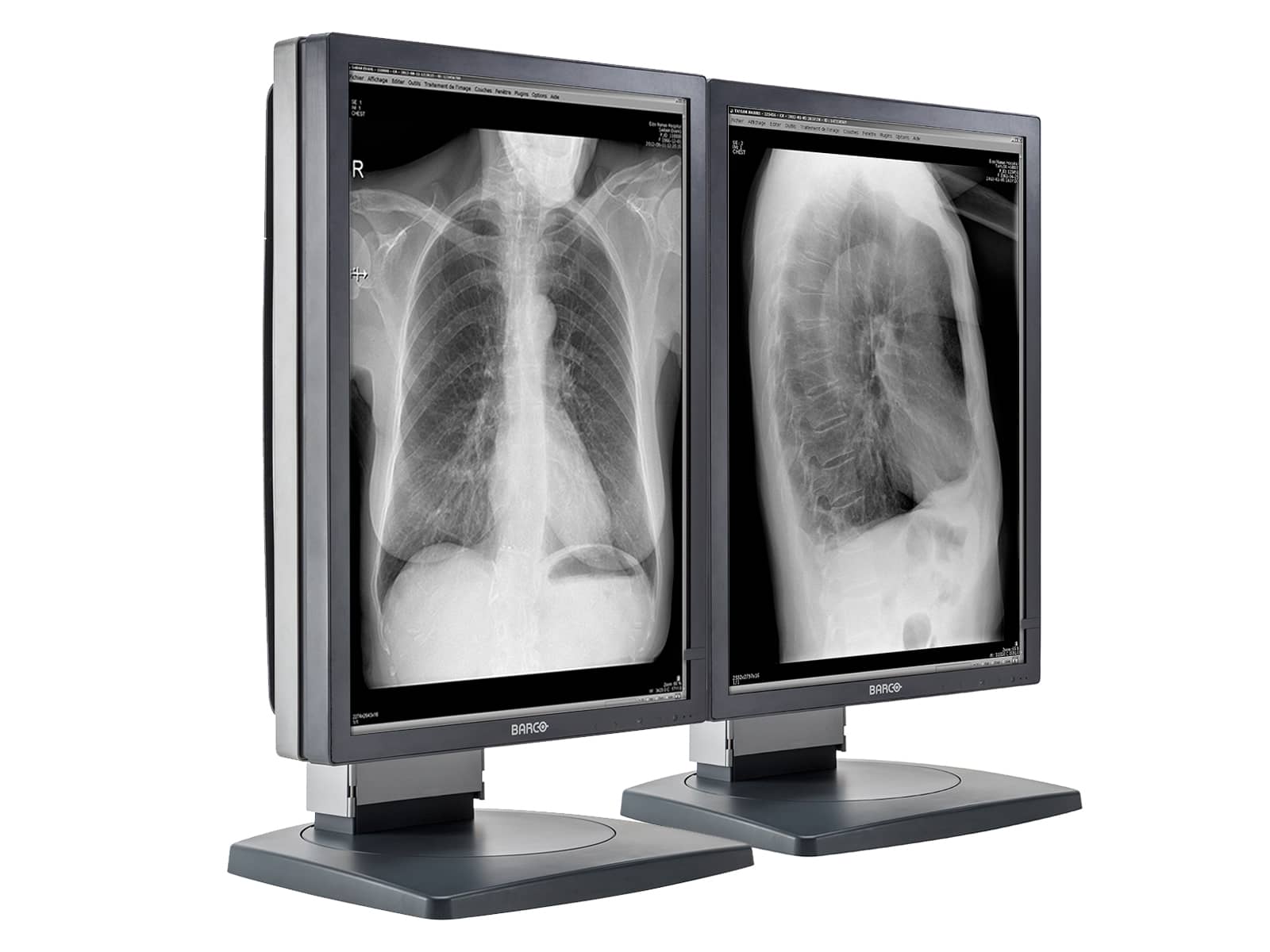 Barco Coronis MDCG-3120 3MP 20" Grayscale General Radiology Diagnostic Display Monitors.com 