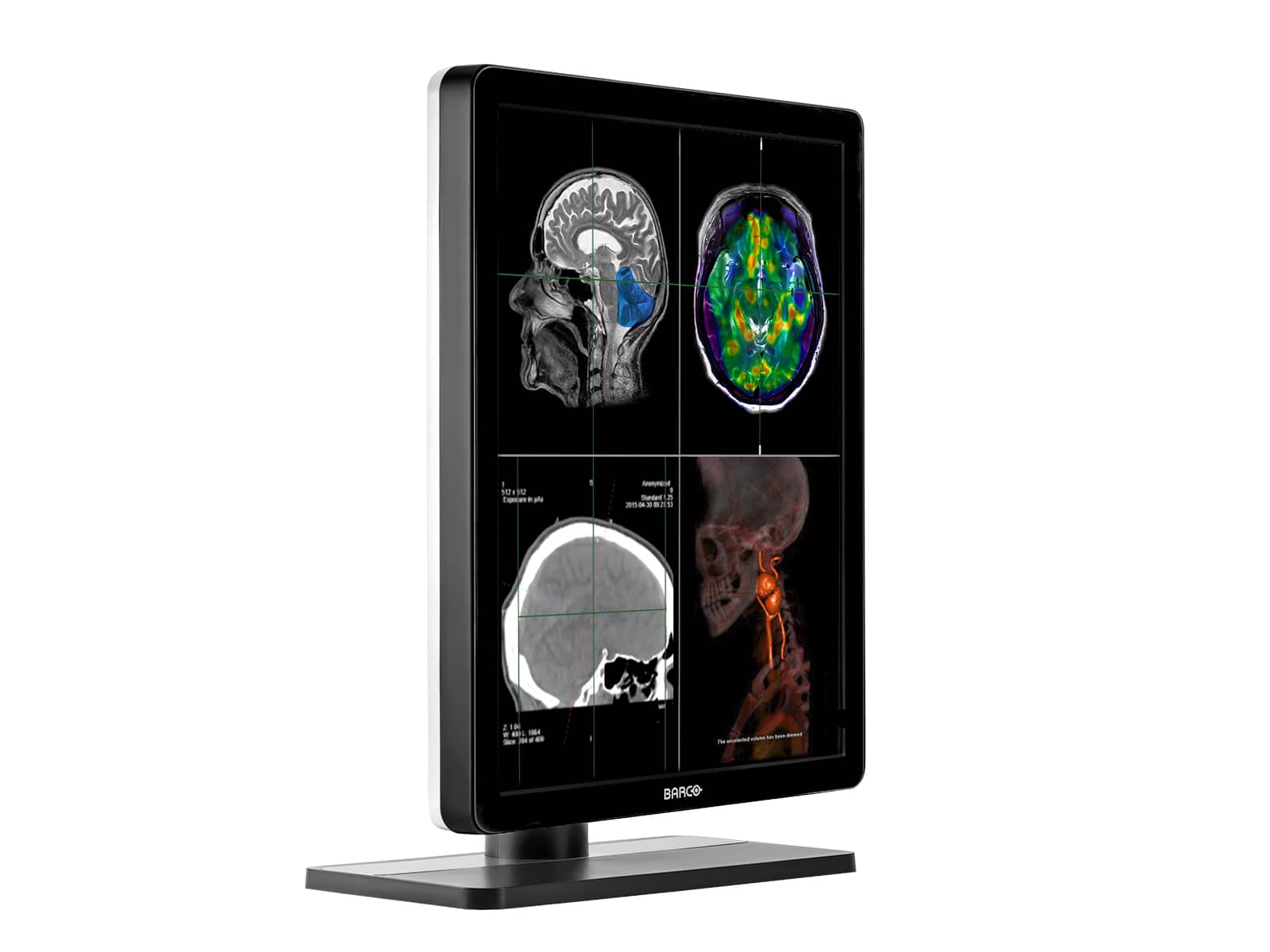 Barco Nio MDNC-3321 3MP 21" Color LED General Radiology Diagnostic PACS Display (Copy) Monitors.com 