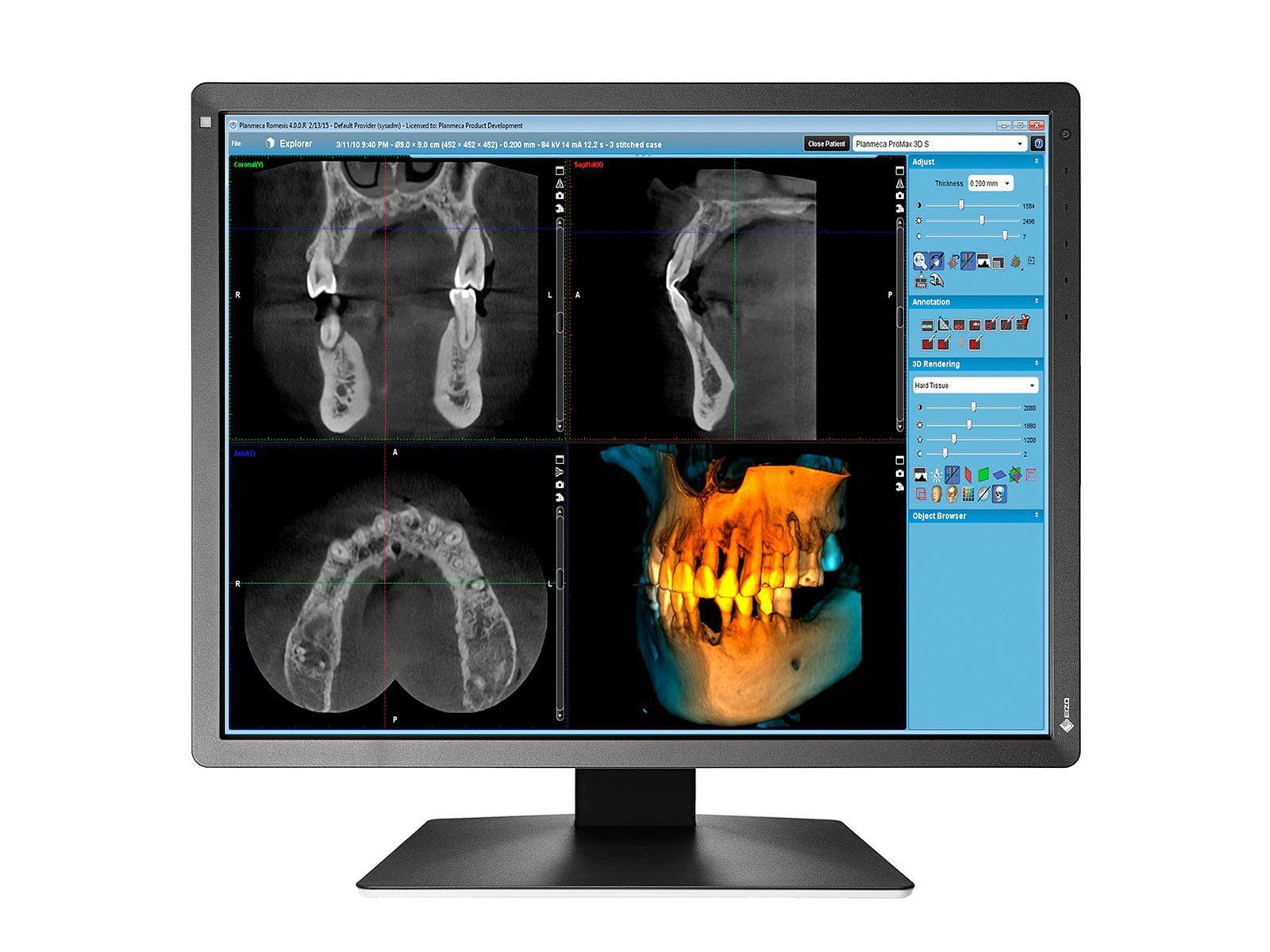 Eizo RadiForce MX216 2MP 21" Color LED Medical Display Monitor (MX216-BK) Monitors.com 