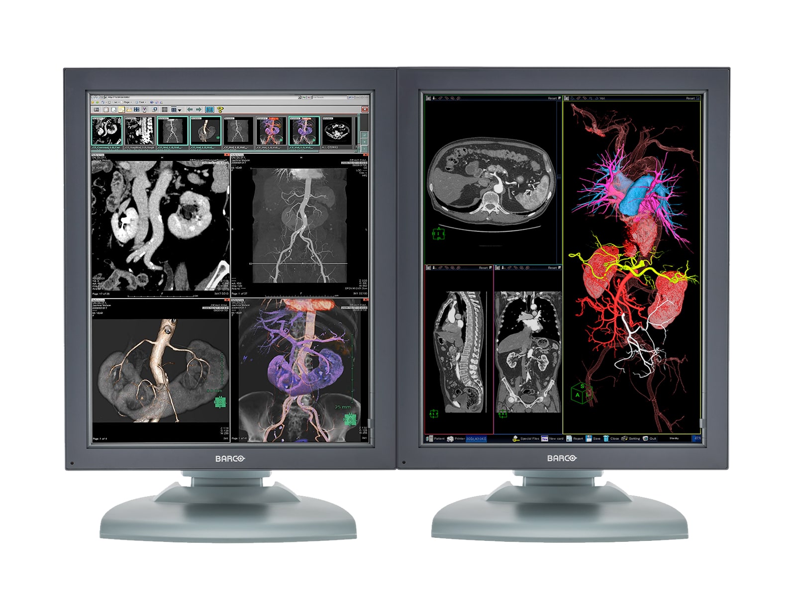 Barco Nio MDNC-3121 HighBright 3MP 21" Color Medical Diagnostic Radiology Monitor Monitors.com 