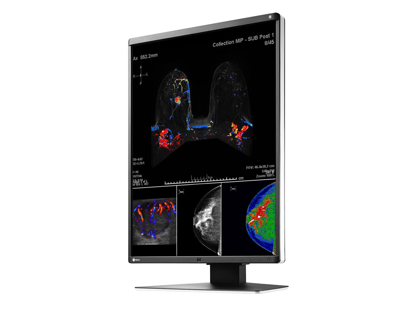 Eizo RadiForce RX560 5MP 21" Color LED Mammo 3D-DBT Breast Imaging Display (RX560-BK) Monitors.com 