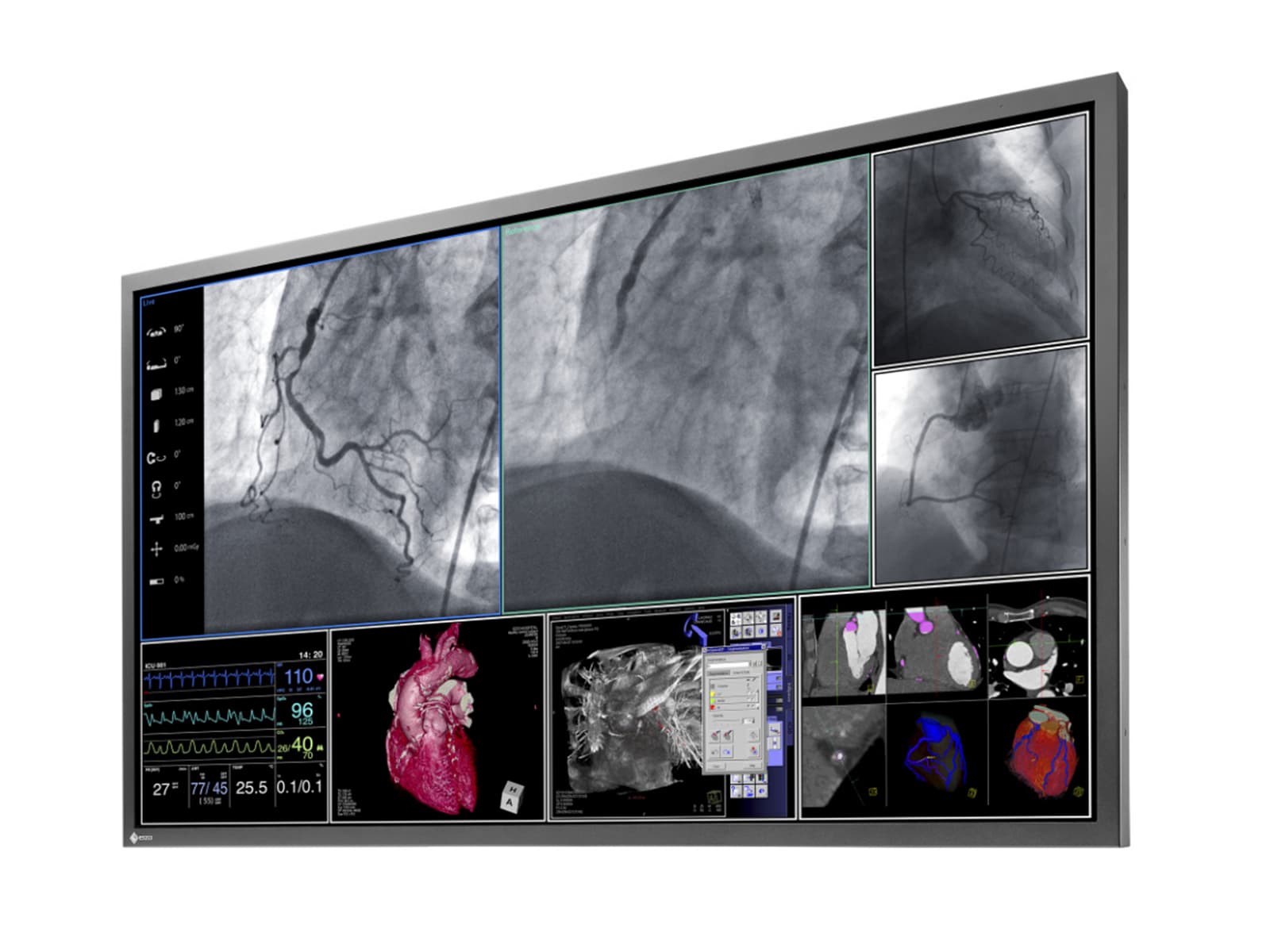 Eizo RadiForce LS580W 8MP 58" 4K Surgical Medical Display (LS580W) Monitors.com 