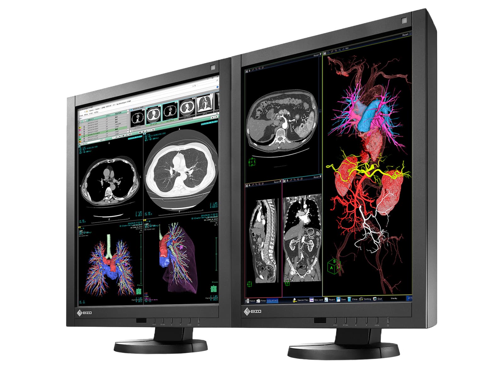 Eizo Radiforce RX340 3MP 21" Color LED General Radiology Diagnostic PACS Display (RX340-BK) Monitors.com 